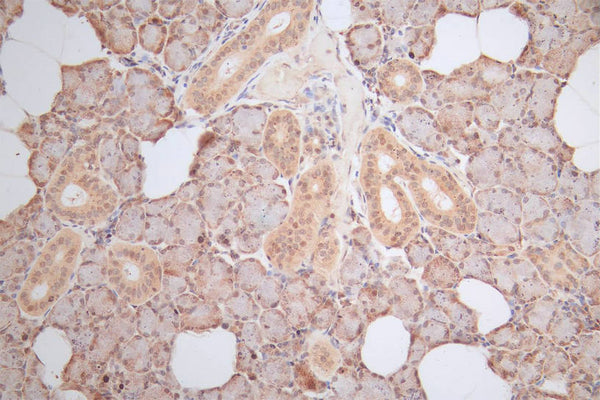 IHC image of CSB-RA010553MA1HU diluted at 1:100 and staining in paraffin-embedded human salivary gland tissue performed on a Leica BondTM system. After dewaxing and hydration,  antigen retrieval was mediated by high pressure in a citrate buffer (pH 6.0) . Section was blocked with 10% normal goat serum 30min at RT. Then primary antibody (1% BSA) was incubated at 4°C overnight. The primary is detected by a Goat anti-Mouse IgG labeled by HRP and visualized using 0.05% DAB.