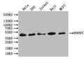 Western Blot
Positive WB detected in: Hela whole cell lysate, 293 whole cell lysate, JK whole cell lysate, Raji whole cell lysate, MCF7 whole cell lysate
All lanes: HNRNPC antibody at 1:1000
Secondary
Goat polyclonal to rabbit IgG at 1/50000 dilution
Predicted band size: 34 kDa
Observed band size: 42 kDa