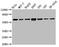 Western Blot
Positive WB detected in: Hela whole cell lysate, MCF-7 whole cell lysate, HepG2 whole cell lysate, 293T whole cell lysate, 293 whole cell lysate, U87 whole cell lysate, SH-SY5Y whole cell lysate
All lanes: HNRNPK antibody at 1.3μg/ml
Secondary
Goat polyclonal to rabbit IgG at 1/50000 dilution
Predicted band size: 51, 52, 49 KDa
Observed band size: 60 KDa