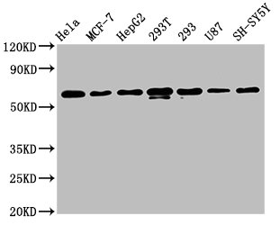 Western Blot
Positive WB detected in: Hela whole cell lysate, MCF-7 whole cell lysate, HepG2 whole cell lysate, 293T whole cell lysate, 293 whole cell lysate, U87 whole cell lysate, SH-SY5Y whole cell lysate
All lanes: HNRNPK antibody at 1.3μg/ml
Secondary
Goat polyclonal to rabbit IgG at 1/50000 dilution
Predicted band size: 51, 52, 49 KDa
Observed band size: 60 KDa