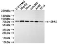 Western Blot
Positive WB detected in: U-251MG whole cell lysate(20µg) , HepG2 whole cell lysate(20µg) , Hela whole cell lysate(20µg) , colo205 whole cell lysate(20µg) , A549 whole cell lysate(20µg) , PC-3 whole cell lysate(20µg) 
All lanes: HSPA5 antibody at 1:1000
Secondary
Goat polyclonal to human IgG at 1/40000 dilution
Predicted band size: 72 kDa
Observed band size: 72 kDa
Exposure time: 2min