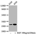 Western Blot
Positive WB detected in A549 whole cell lysate(treated with EGF or not) 
All lanes Phospho-HSPB1 antibody at 1.5μg/ml
Secondary
Goat polyclonal to rabbit IgG at 1/50000 dilution
Predicted band size: 27 KDa
Observed band size: 27 KDa