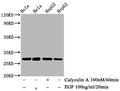 Western Blot
Positive WB detected in Hela whole cell lysate, HepG2 whole cell lysate(treated with Calyculin A or EGF) 
All lanes Phospho-HSPB1 antibody at 0.73μg/ml
Secondary
Goat polyclonal to rabbit IgG at 1/50000 dilution
Predicted band size: 27 KDa
Observed band size: 27 KDa