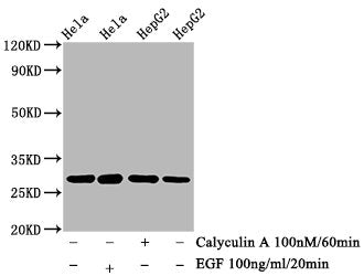 Western Blot
Positive WB detected in Hela whole cell lysate, HepG2 whole cell lysate(treated with Calyculin A or EGF) 
All lanes Phospho-HSPB1 antibody at 0.73μg/ml
Secondary
Goat polyclonal to rabbit IgG at 1/50000 dilution
Predicted band size: 27 KDa
Observed band size: 27 KDa