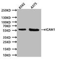 Western Blot
Positive WB detected in:K562 whole cell lysate (20µg) , A375 whole cell lysate (20µg) 
All lanes: ICAM1 antibody at 1:1000
Secondary
Goat polyclonal to human IgG at 1/40000 dilution
Predicted band size:57.83 kDa
Observed band size:58 kDa
Exposure time:120s