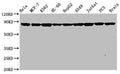 Western Blot
Positive WB detected in: Hela whole cell lysate, MCF-7 whole cell lysate, K562 whole cell lysate, HL-60 whole cell lysate, HepG2 whole cell lysate, A549 whole cell lysate, Jurkat whole cell lysate, PC3 whole cell lysate, Rat brain tissue
All lanes: Hsp90 alpha antibody at 0.8μg/ml
Secondary
Goat polyclonal to rabbit IgG at 1/50000 dilution
Predicted band size: 85, 99 KDa
Observed band size: 85 KDa