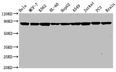Western Blot
Positive WB detected in: Hela whole cell lysate, MCF-7 whole cell lysate, K562 whole cell lysate, HL-60 whole cell lysate, HepG2 whole cell lysate, A549 whole cell lysate, Jurkat whole cell lysate, PC3 whole cell lysate, Rat brain tissue
All lanes: Hsp90 alpha antibody at 0.8μg/ml
Secondary
Goat polyclonal to rabbit IgG at 1/50000 dilution
Predicted band size: 85, 99 KDa
Observed band size: 85 KDa