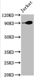 Western Blot
Positive WB detected in: Jurkat whole cell lysate
All lanes: Hsp90 alpha antibody at 1.9μg/ml
Secondary
Goat polyclonal to rabbit IgG at 1/50000 dilution
Predicted band size: 85, 99 KDa
Observed band size: 90 KDa