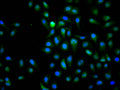 Immunofluorescence staining of Hela cell with CSB-RA011511A0HU at 1:50, counter-stained with DAPI. The cells were fixed in 4% formaldehyde, permeabilized using 0.2% Triton X-100 and blocked in 10% normal Goat Serum. The cells were then incubated with the antibody overnight at 4°C. The secondary antibody was Alexa Fluor 488-congugated AffiniPure Goat Anti-Rabbit IgG(H+L) .