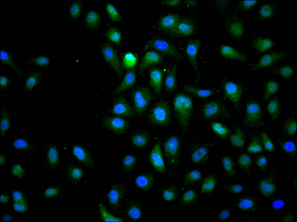 Immunofluorescence staining of Hela cell with CSB-RA011511A0HU at 1:50, counter-stained with DAPI. The cells were fixed in 4% formaldehyde, permeabilized using 0.2% Triton X-100 and blocked in 10% normal Goat Serum. The cells were then incubated with the antibody overnight at 4°C. The secondary antibody was Alexa Fluor 488-congugated AffiniPure Goat Anti-Rabbit IgG(H+L) .
