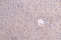 IHC image of CSB-RA011591MA1HU diluted at 1:200 and staining in paraffin-embedded human liver tissue performed on a Leica BondTM system. After dewaxing and hydration, antigen retrieval was mediated by high pressure in a citrate buffer (pH 6.0) . Section was blocked with 10% normal goat serum 30min at RT. Then primary antibody (1% BSA) was incubated at 4°C overnight. The primary is detected by a Goat anti-human polymer IgG labeled by HRP and visualized using 0.05% DAB.