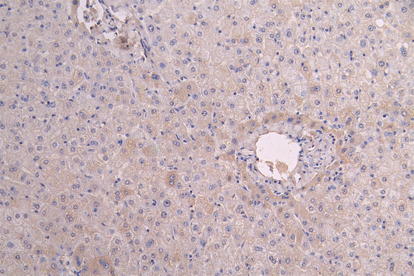 IHC image of CSB-RA011591MA1HU diluted at 1:200 and staining in paraffin-embedded human liver tissue performed on a Leica BondTM system. After dewaxing and hydration, antigen retrieval was mediated by high pressure in a citrate buffer (pH 6.0) . Section was blocked with 10% normal goat serum 30min at RT. Then primary antibody (1% BSA) was incubated at 4°C overnight. The primary is detected by a Goat anti-human polymer IgG labeled by HRP and visualized using 0.05% DAB.