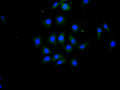 Immunofluorescence staining of MCF7 cell with CSB-RA011593MA1HU at 1:100, counter-stained with DAPI. The cells were fixed in 4% formaldehyde and blocked in 10% normal Goat Serum. The cells were then incubated with the antibody overnight at 4C. The secondary antibody was FITC-conjugated AffiniPure Goat Anti-Human IgG(H+L) .