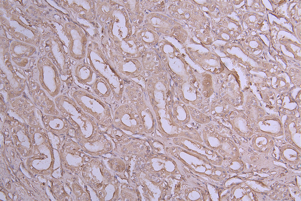 IHC image of CSB-RA011614MA1HU diluted at 1:100 and staining in paraffin-embedded human kidney tissue performed on a Leica BondTM system. After dewaxing and hydration, antigen retrieval was mediated by high pressure in a citrate buffer (pH 6.0) . Section was blocked with 10% normal goat serum 30min at RT. Then primary antibody (1% BSA) was incubated at 4°C overnight. The primary is detected by a Goat anti-Human IgG labeled by HRP and visualized using 0.05% DAB.