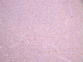 IHC image of CSB-RA011629MA3HU diluted at 1:50 and staining in paraffin-embedded human tonsil tissue performed on a Leica BondTM system. After dewaxing and hydration, antigen retrieval was mediated by high pressure in a citrate buffer (pH 6.0). Section was blocked with 10% normal goat serum 30min at RT. Then primary antibody (1% BSA) was incubated at 4°C overnight. The primary is detected by a Goat anti-mouse polymer IgG labeled by HRP and visualized using 0.05% DAB.