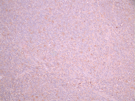 IHC image of CSB-RA011629MA3HU diluted at 1:50 and staining in paraffin-embedded human tonsil tissue performed on a Leica BondTM system. After dewaxing and hydration, antigen retrieval was mediated by high pressure in a citrate buffer (pH 6.0). Section was blocked with 10% normal goat serum 30min at RT. Then primary antibody (1% BSA) was incubated at 4°C overnight. The primary is detected by a Goat anti-mouse polymer IgG labeled by HRP and visualized using 0.05% DAB.