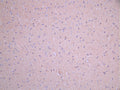 IHC image of CSB-RA011658MA1HU diluted at 1:50 and staining in paraffin-embedded mouse brain tissue performed on a Leica BondTM system. After dewaxing and hydration, antigen retrieval was mediated by high pressure in a citrate buffer (pH 6.0). Section was blocked with 10% normal goat serum 30min at RT. Then primary antibody (1% BSA) was incubated at 4°C overnight. The primary is detected by a Anti-Human lgG, Fcy Fragment Specific labeled by HRP and visualized using 0.05% DAB.