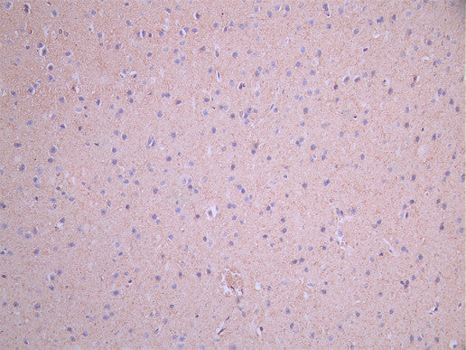 IHC image of CSB-RA011658MA1HU diluted at 1:50 and staining in paraffin-embedded mouse brain tissue performed on a Leica BondTM system. After dewaxing and hydration, antigen retrieval was mediated by high pressure in a citrate buffer (pH 6.0). Section was blocked with 10% normal goat serum 30min at RT. Then primary antibody (1% BSA) was incubated at 4°C overnight. The primary is detected by a Anti-Human lgG, Fcy Fragment Specific labeled by HRP and visualized using 0.05% DAB.