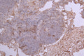 IHC image of CSB-RA011664MA2HU diluted at 1:100 and staining in paraffin-embedded human lymph node tissue performed on a Leica BondTM system. After dewaxing and hydration, antigen retrieval was mediated by high pressure in a citrate buffer (pH 6.0) . Section was blocked with 10% normal goat serum 30min at RT. Then primary antibody (1% BSA) was incubated at 4°C overnight. The primary is detected by a Goat anti-Human IgG labeled by HRP and visualized using 0.05% DAB.
