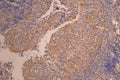 IHC image of CSB-RA011664MA3HU diluted at 1：50 and staining in paraffin-embedded human tonsil tissue performed on a Leica BondTM system. After dewaxing and hydration, antigen retrieval was mediated by high pressure in a citrate buffer (pH 6.0) . Section was blocked with 10% normal goat serum 30min at RT. Then primary antibody (1% BSA) was incubated at 4°C overnight. The primary is detected by a Anti-Human lgG, Fcy Fragment Specific labeled by HRP and visualized using 0.05% DAB.