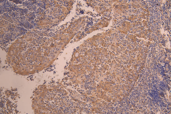 IHC image of CSB-RA011664MA3HU diluted at 1：50 and staining in paraffin-embedded human tonsil tissue performed on a Leica BondTM system. After dewaxing and hydration, antigen retrieval was mediated by high pressure in a citrate buffer (pH 6.0) . Section was blocked with 10% normal goat serum 30min at RT. Then primary antibody (1% BSA) was incubated at 4°C overnight. The primary is detected by a Anti-Human lgG, Fcy Fragment Specific labeled by HRP and visualized using 0.05% DAB.
