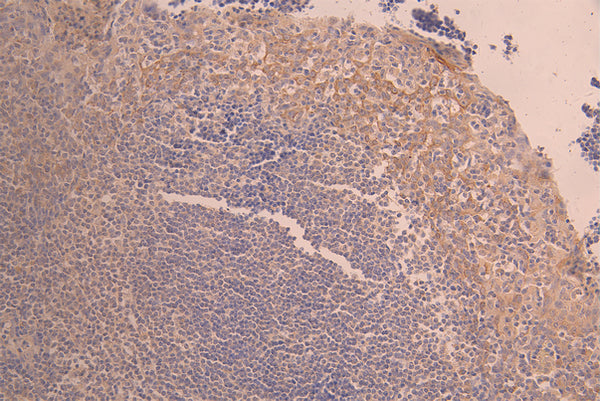 IHC image of CSB-RA011664MA4HU diluted at 1：50 and staining in paraffin-embedded human tonsil tissue performed on a Leica BondTM system. After dewaxing and hydration, antigen retrieval was mediated by high pressure in a citrate buffer (pH 6.0) . Section was blocked with 10% normal goat serum 30min at RT. Then primary antibody (1% BSA) was incubated at 4°C overnight. The primary is detected by a Anti-Human lgG, Fcy Fragment Specific labeled by HRP and visualized using 0.05% DAB.