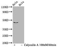 Western Blot
Positive WB detected in Hela whole cell lysate(treated with Calyculin A or not) 
All lanes Phospho-IRF3 antibody at 1.03μg/ml
Secondary
Goat polyclonal to rabbit IgG at 1/50000 dilution
Predicted band size: 47 KDa
Observed band size: 47 KDa