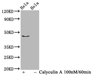 Western Blot
Positive WB detected in Hela whole cell lysate(treated with Calyculin A or not) 
All lanes Phospho-IRF3 antibody at 1.03μg/ml
Secondary
Goat polyclonal to rabbit IgG at 1/50000 dilution
Predicted band size: 47 KDa
Observed band size: 47 KDa