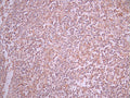 IHC image of CSB-RA011867MA1HU diluted at 1:50 and staining in paraffin-embedded human lymph node tissue performed on a Leica BondTM system. After dewaxing and hydration, antigen retrieval was mediated by high pressure in a citrate buffer (pH 6.0). Section was blocked with 10% normal goat serum 30min at RT. Then primary antibody (1% BSA) was incubated at 4°C overnight. The primary is detected by a Anti-Human lgG, Fcy Fragment Specific labeled by HRP and visualized using 0.05% DAB.