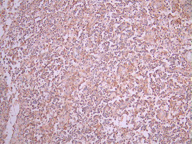 IHC image of CSB-RA011867MA1HU diluted at 1:50 and staining in paraffin-embedded human lymph node tissue performed on a Leica BondTM system. After dewaxing and hydration, antigen retrieval was mediated by high pressure in a citrate buffer (pH 6.0). Section was blocked with 10% normal goat serum 30min at RT. Then primary antibody (1% BSA) was incubated at 4°C overnight. The primary is detected by a Anti-Human lgG, Fcy Fragment Specific labeled by HRP and visualized using 0.05% DAB.