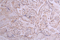 IHC image of CSB-RA011868MA1HU diluted at 1:50 and staining in paraffin-embedded human placenta tissue performed on a Leica BondTM system. After dewaxing and hydration, antigen retrieval was mediated by high pressure in a citrate buffer (pH 6.0) . Section was blocked with 10% normal goat serum 30min at RT. Then primary antibody (1% BSA) was incubated at 4°C overnight. The primary is detected by a Goat anti-human polymer IgG labeled by HRP and visualized using 0.05% DAB.