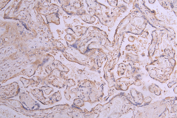 IHC image of CSB-RA011868MA1HU diluted at 1:50 and staining in paraffin-embedded human placenta tissue performed on a Leica BondTM system. After dewaxing and hydration, antigen retrieval was mediated by high pressure in a citrate buffer (pH 6.0) . Section was blocked with 10% normal goat serum 30min at RT. Then primary antibody (1% BSA) was incubated at 4°C overnight. The primary is detected by a Goat anti-human polymer IgG labeled by HRP and visualized using 0.05% DAB.