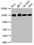Western Blot
Positive WB detected in: Hela whole cell lysate, MCF-7 whole cell lysate, SH-SY5Y whole cell lysate, U251 whole cell lysate
All lanes: Integrin beta-1/CD29 antibody at 1.9μg/ml
Secondary
Goat polyclonal to rabbit IgG at 1/50000 dilution
Predicted band size: 89, 88, 92 KDa
Observed band size: 130 KDa