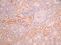 IHC image of CSB-RA011892MA1HU diluted at 1:50 and staining in paraffin-embedded human kidney tissue performed on a Leica BondTM system. After dewaxing and hydration, antigen retrieval was mediated by high pressure in a citrate buffer (pH 6.0). Section was blocked with 10% normal goat serum 30min at RT. Then primary antibody (1% BSA) was incubated at 4°C overnight. The primary is detected by a Anti-Human lgG, Fcy Fragment Specific labeled by HRP and visualized using 0.05% DAB.