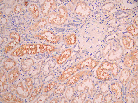 IHC image of CSB-RA011892MA1HU diluted at 1:50 and staining in paraffin-embedded human kidney tissue performed on a Leica BondTM system. After dewaxing and hydration, antigen retrieval was mediated by high pressure in a citrate buffer (pH 6.0). Section was blocked with 10% normal goat serum 30min at RT. Then primary antibody (1% BSA) was incubated at 4°C overnight. The primary is detected by a Anti-Human lgG, Fcy Fragment Specific labeled by HRP and visualized using 0.05% DAB.