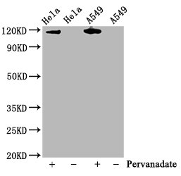Phospho-JAK2 (Y1007 + Y1008) Antibody – Figure 1 of 4
