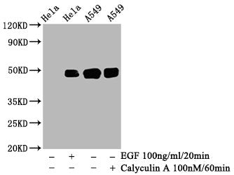 Western Blot
Positive WB detected in: Hela whole cell lysate, A549 whole cell lysate(treated with Calyculin A or EGF) 
All lanes: Phospho-JUN antibody at 0.95μg/ml
Secondary
Goat polyclonal to rabbit IgG at 1/50000 dilution
Predicted band size: 48 KDa
Observed band size: 48 KDa