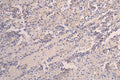 KDR Recombinant Monoclonal Antibody – Figure 1 of 1