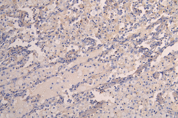 KDR Recombinant Monoclonal Antibody – Figure 1 of 1