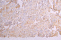 IHC image of CSB-RA012352MA1HU diluted at 1：100 and staining in paraffin-embedded human lung tissue performed on a Leica BondTM system. After dewaxing and hydration, antigen retrieval was mediated by high pressure in a citrate buffer (pH 6.0) . Section was blocked with 10% normal goat serum 30min at RT. Then primary antibody (1% BSA) was incubated at 4°C overnight. The primary is detected by a Goat anti-human polymer IgG labeled by HRP and visualized using 0.05% DAB.