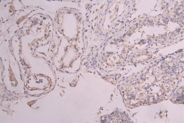 KIT Recombinant Monoclonal Antibody – Figure 1 of 2