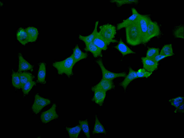 Immunofluorescence staining of MCF-7 cell with CSB-RA012519MA1HU at 1:30 ,counter-stained with DAPI. The cells were fixed in 4% formaldehyde, permeabilized using 0.2% Triton X-100 and blocked in 10% normal Goat Serum. The cells were then incubated with the antibody overnight at 4°C. The secondary antibody was Alexa Fluor 488-congugated AffiniPure Goat Anti-Human IgG(H+L) .