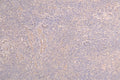 IHC image of CSB-RA012719MA1HU diluted at 1：100 and staining in paraffin-embedded human testis tissue performed on a Leica BondTM system. After dewaxing and hydration, antigen retrieval was mediated by high pressure in a citrate buffer (pH 6.0) . Section was blocked with 10% normal goat serum 30min at RT. Then primary antibody (1% BSA) was incubated at 4°C overnight. The primary is detected by a Goat anti-human polymer IgG labeled by HRP and visualized using 0.05% DAB.