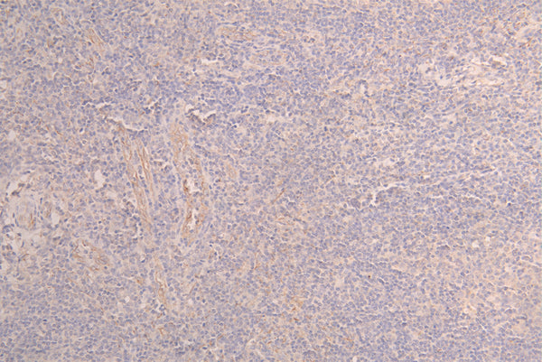 IHC image of CSB-RA012719MA1HU diluted at 1：100 and staining in paraffin-embedded human testis tissue performed on a Leica BondTM system. After dewaxing and hydration, antigen retrieval was mediated by high pressure in a citrate buffer (pH 6.0) . Section was blocked with 10% normal goat serum 30min at RT. Then primary antibody (1% BSA) was incubated at 4°C overnight. The primary is detected by a Goat anti-human polymer IgG labeled by HRP and visualized using 0.05% DAB.