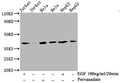 Western Blot
Positive WB detected in:Jurkat whole cell lysate, Hela whole cell lysate, HepG2 whole cell lysate(treated with EGF or Pervanadate) 
All lanes: Phospho-LAT antibody at 2.9μg/ml
Secondary
Goat polyclonal to rabbit IgG at 1/50000 dilution
Predicted band size: 38 KDa
Observed band size: 38 KDa