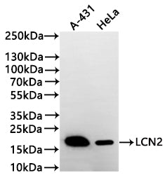 Western Blot
Positive WB detected in: A-431 whole cell lysate(30µg) , Hela whole cell lysate(30µg) 
All lanes: LCN2 antibody at 1:1000
Secondary
Goat polyclonal to human IgG at 1/40000 dilution
Predicted band size: 22 kDa
Observed band size: 22 kDa
Exposure time: 2min