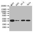 Western Blot
Positive WB detected in: PC-3 whole cell lysate, MCF7 whole cell lysate, Hela whole cell lysate, A431 whole cell lysate
All lanes: LGALS3 antibody at 1:1000
Secondary
Goat polyclonal to human IgG at 1/50000 dilution
Predicted band size: 26 kDa
Observed band size: 26 kDa