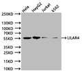 Western Blot
Positive WB detected in:Hela whole cell lysate (20µg) , HpeG2 whole cell lysate (20µg) , Jurkat whole cell lysate (20µg) , K562 whole cell lysate (20µg) 
All lanes: LILRA4 antibody at 1:1000
Secondary
Goat polyclonal to human IgG at 1/40000 dilution
Predicted band size:55.18, 47.81 kDa
Observed band size:50 kDa
Exposure time:20s