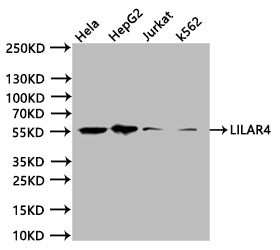 Western Blot
Positive WB detected in:Hela whole cell lysate (20µg) , HpeG2 whole cell lysate (20µg) , Jurkat whole cell lysate (20µg) , K562 whole cell lysate (20µg) 
All lanes: LILRA4 antibody at 1:1000
Secondary
Goat polyclonal to human IgG at 1/40000 dilution
Predicted band size:55.18, 47.81 kDa
Observed band size:50 kDa
Exposure time:20s