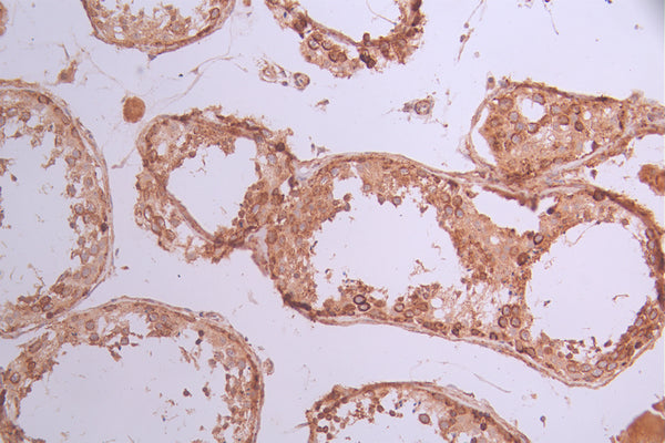 IHC image of CSB-RA012968A0HU diluted at 1:100 and staining in paraffin-embedded human testis tissue performed on a Leica BondTM system. After dewaxing and hydration, antigen retrieval was mediated by high pressure in a citrate buffer (pH 6.0) . Section was blocked with 10% normal goat serum 30min at RT. Then primary antibody (1% BSA) was incubated at 4°C overnight. The primary is detected by a Goat anti-rabbit polymer IgG labeled by HRP and visualized using 0.05% DAB.